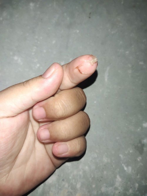 สอบถามแม่ๆหน่อยค่ะ🥺