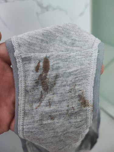 Implantation Bleeding ba to?