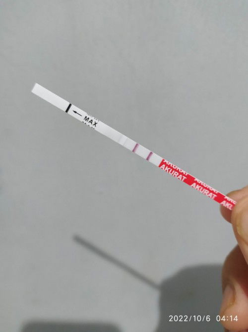 Mulai usg di usia kandungan berapa