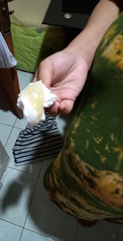 Keputihan menggumpal