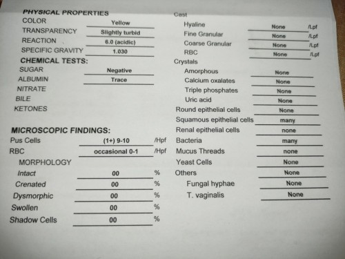 URINALYSIS RESULT