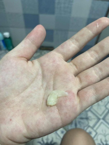 สอบถามหน่อยค่ะแม่ๆ