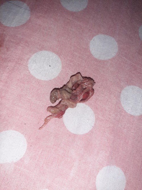 Ano po kaya tong lumabas sa pwerta ko?? .. 1month ng nakakalipas ng nanganak ako . nag worry po kasi