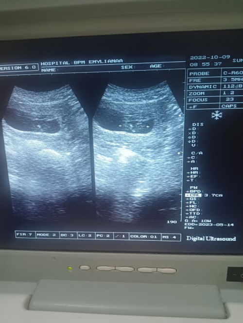 Hamil 12w kluar flek sudah 2hari