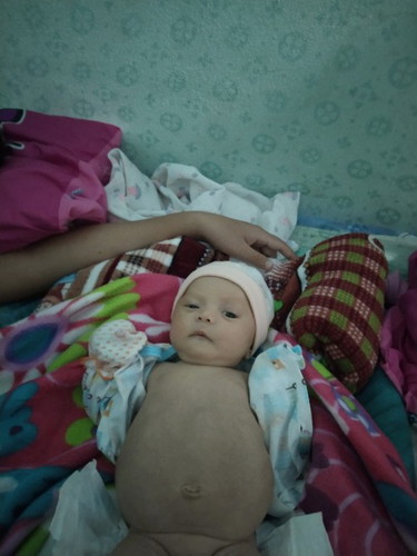 ลูกท้องพุง