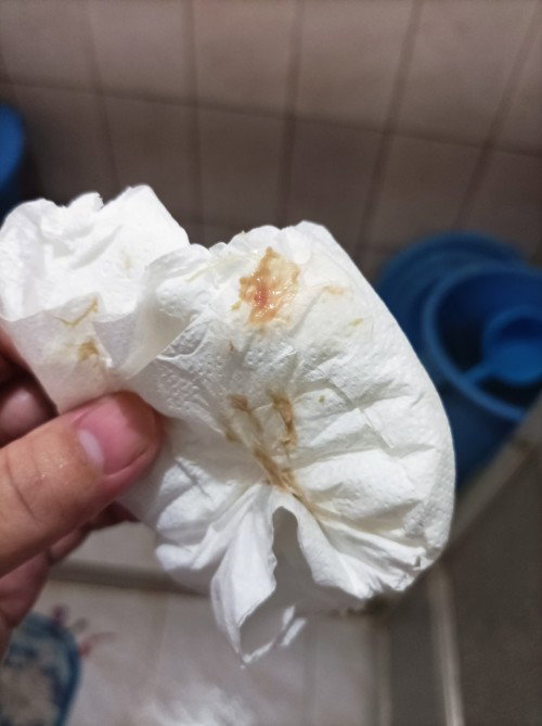 May lumabas na po saken ng ganito parang white and redblood na halo 37 weeks na po ako.