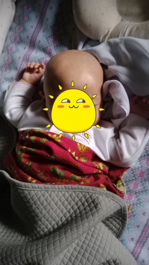 Kepala bayi normal