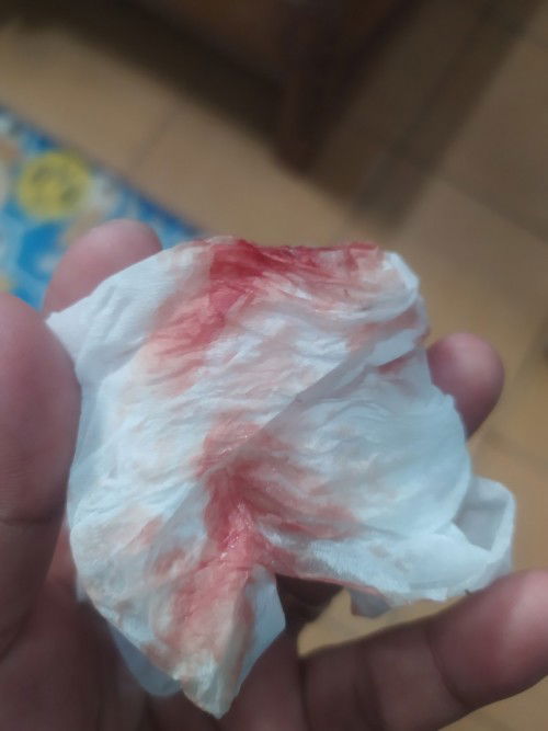 Hamil 24weeks keluar flek