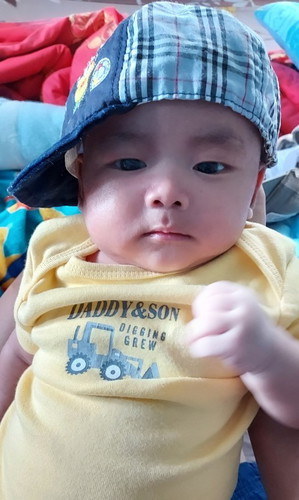 ลูก1เดือน18วันชอบแหงนมองข้างบนผิดปรกติมั้ยคะ