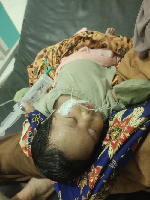 Anak sy di diagnosa hisprung