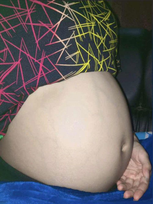 29w+1 แล้วงับ ทีม 25 ธันวาคม #ผ่างับ
แม่ๆบ้านอื่นเท่าไหร่กันแล้วน้าา🥰❤️