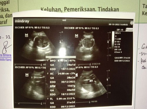 Bagaimana cara menaikan BB janin