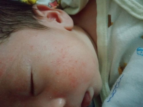 เรื่องวุ่นๆของวัยรุ่นเเรกเกิด