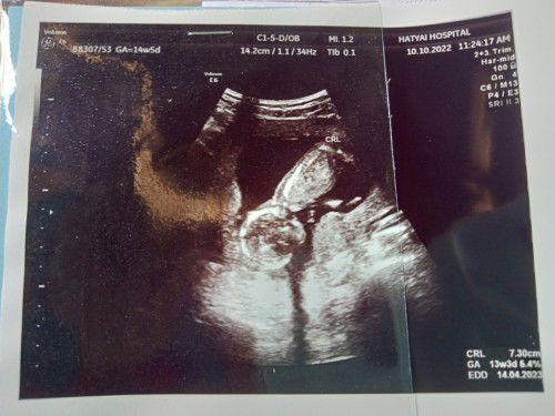 ตั้งครรภ์3เดือน