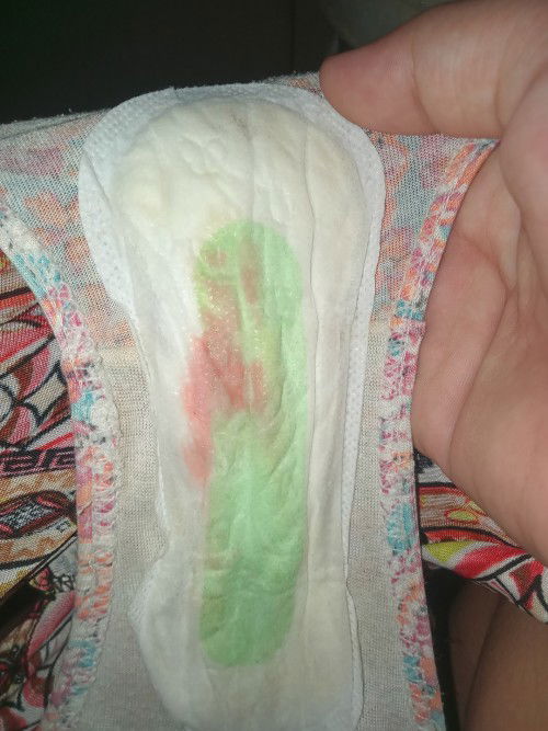 Mga mhie ano ibigsabihin nito 39weeks napo ako may lumabas saking dugo