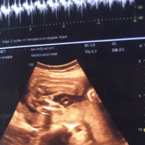 29สัปดาร์แม้เองดูอัตาสาวหมอไม้รูว้าเป็นเพศหญิงเรือชายแม้ๆๆทีมีปสุบการชวยบอกทีว่าเพสใหน