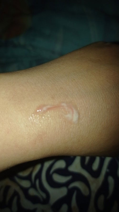 Apa udah ada yg pernah ngalamin bund