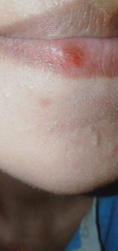 Terjadi sesuatu pada bibir