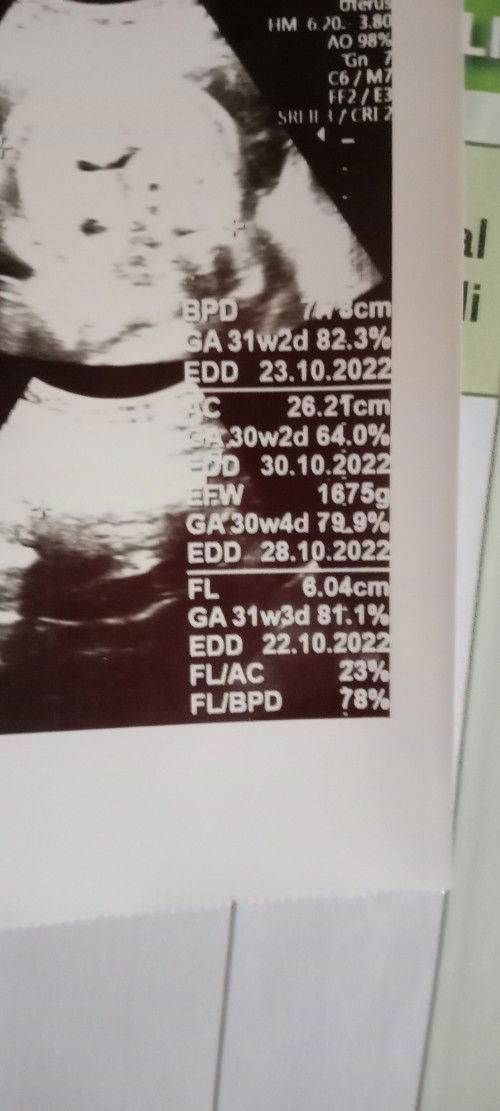 Bingung soal hpl bun