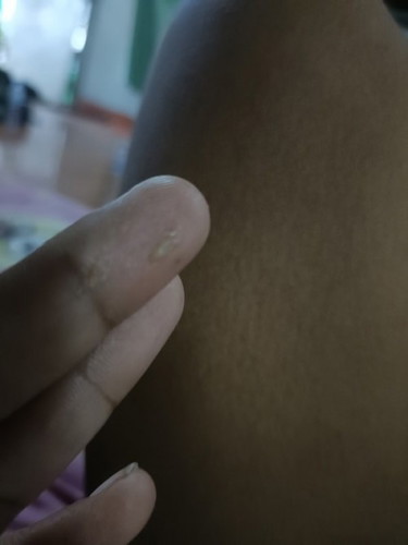 มีหมูกขาวๆดหนียวๆค่ะ วิ่งหนีควายตกใจ และก้มานอนปวดท้องท้องด้านล้างปะ้นเปนก้อนเลยนอน2ชมดีขึ้น