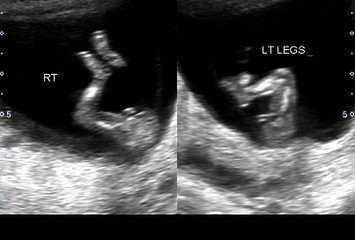 Boy or girl?
