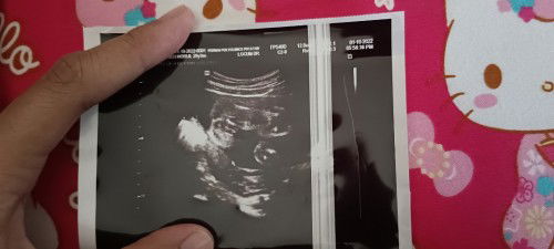 assalamualaikum ibu2 smau,pnjam mta boy@girl