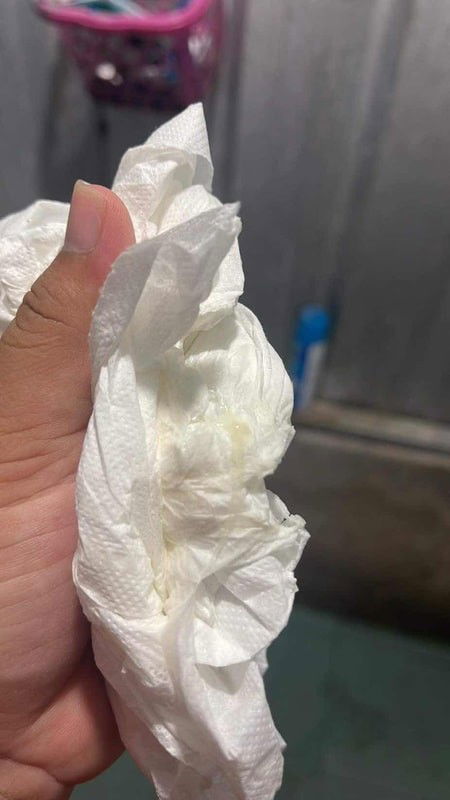 อันนี้มูกใสหรือตกขาวคะแม่ๆ 33+3ค่ะ มีอาการหน่วงๆท้อง