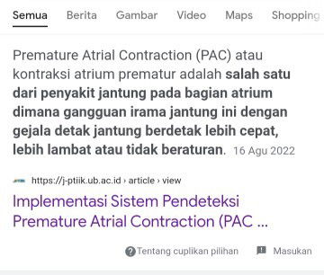Bunda, apakah premature atrial contraction pada jantung mempengaruhi janin?
