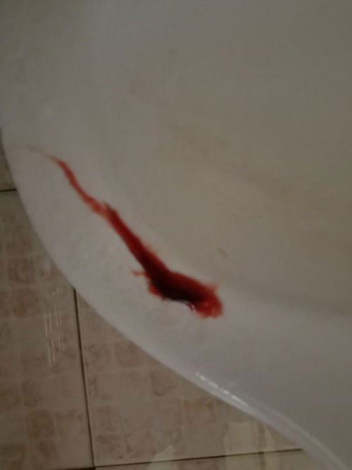 อาการใกล้คลอดมั้ย