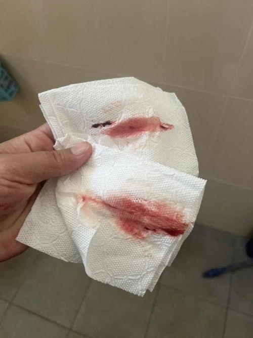 กระตุ้นปากมดลูก