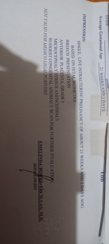 May nkakalam po ba ng meaning ng microcephaly vs anencephaly as ultrasound result?