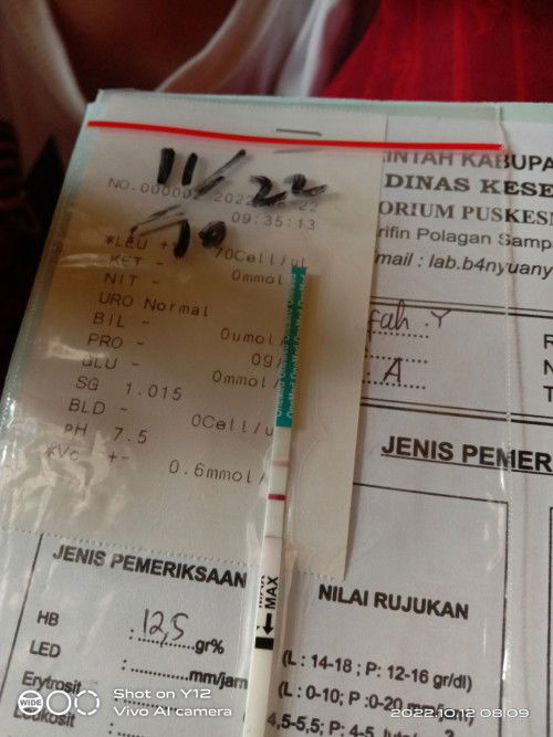 Kehamilan yg tak nampak