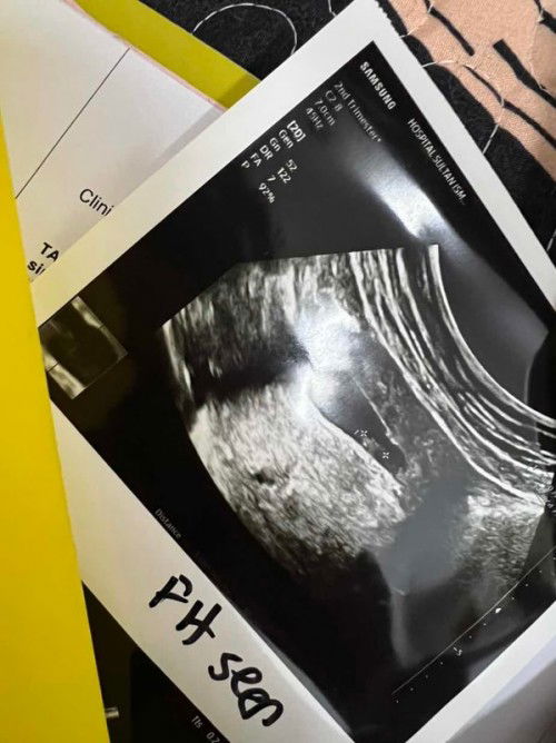 Hello Mommies, 4/10 hari tu saya check up dgn klinik pakar, siap scan semua lahh ya. Masa doc scan