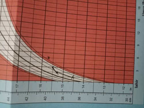 Lilitan kepala anak kecik