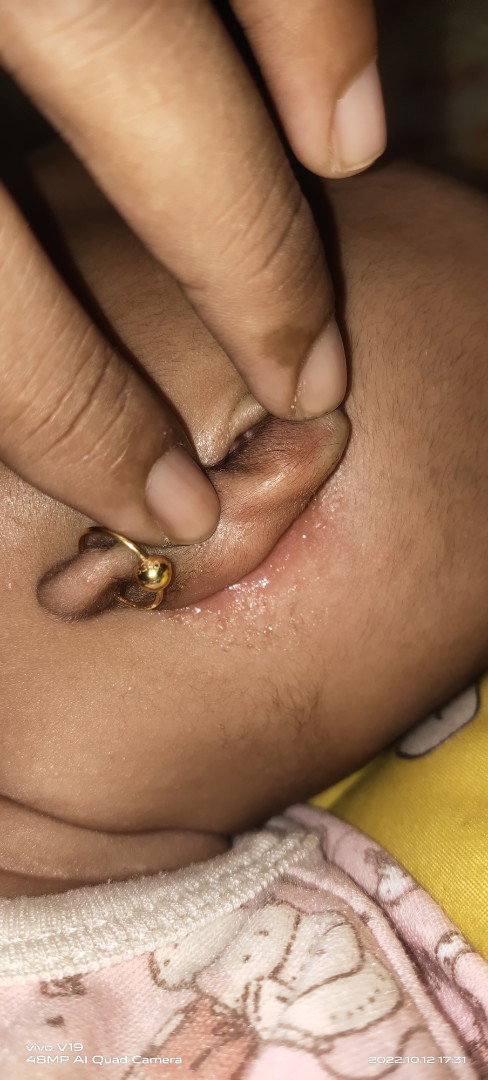 Belakang kuping bayi