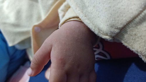 Ini kira² kenapa ya Bun terus cara ngobatinnya gimana ?