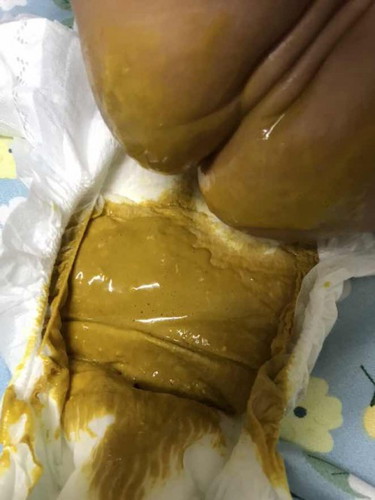 Najis bayi cair