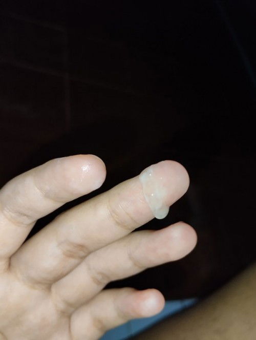 มูจใสๆแบบนี้คืออะไรคะเป็นรอบที่2แล้ว