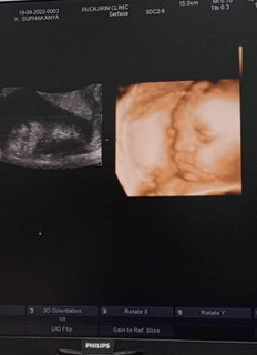 แวะมาอวดลูกชาย