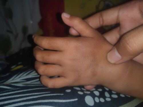 Ada yg tau gk bun kenapa ya kulit anak saya ada warna coklat gitu ?