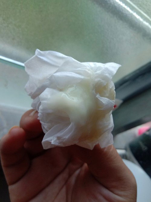 Macam mana nak bezakan lendir tanda bersalin atau keputihan