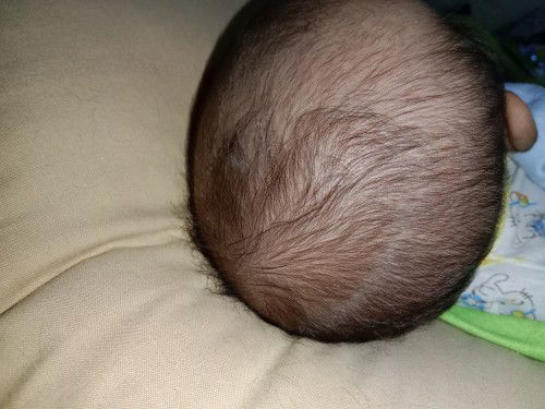 Rambut bayi