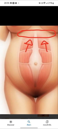 มีใครเป็นเหมือนกันไหมค้าบ