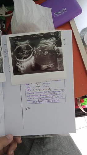 Jadwal USG pagi ini si dd lagi tengkurep