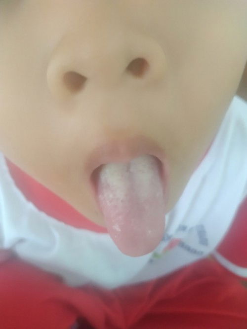 Lưỡi của bé