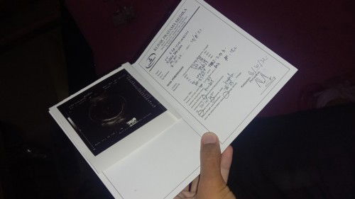 Usg pngn cepat lahir