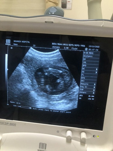 19 week น้ำหนักเด็กในท้อง5ขีด