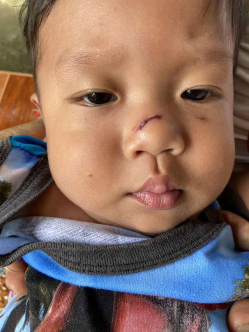 รักษาแผลยังไงให้หาย