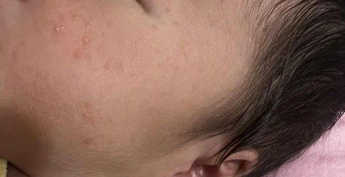 Ada yg samaan kayak gini gak ?