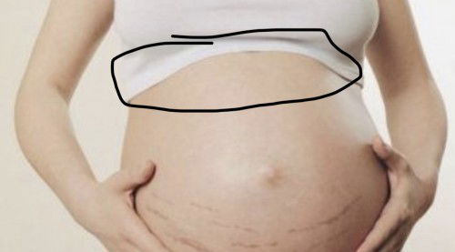 Sakit dekat bahagian